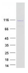 SDS-PAGE (GPLD1-2251H).jpg